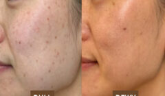 MOLD Manila Launches Radiance-Boosting Treatments to Transform Skin from Dull to Dewy (2)