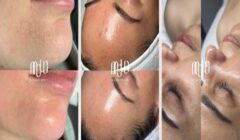 MOLD Manila Redefines Radiance with Science-Based Non-Surgical Aesthetic Care in Quezon City