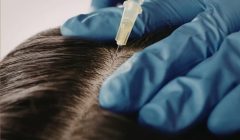 Advanced Scalp Treatment Offers New Hope for Hair Loss Solutions in the Philippines