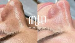 Why OFWs Choose Mold Manila for Safe, Time‑Efficient Aesthetic Care During Philippine Visits (1)