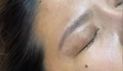 Mold Manila Spotlights Mold Plasma Lift The Non-Surgical Alternative for Lids, Lines, and Sagging Skin